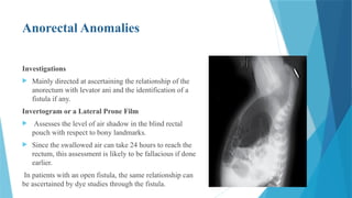 Common surgical conditions in new born.pptx