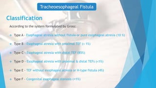 Classification
According to the system formulated by Gross:
 Type A – Esophageal atresia without fistula or pure esophageal atresia (10 %)
 Type B – Esophageal atresia with proximal TEF (˂ 1%)
 Type C – Esophageal atresia with distal TEF (85%)
 Type D – Esophageal atresia with proximal & distal TEFs (˂1%)
 Type E – TEF without esophageal atresia or H-type fistula (4%)
 Type F – Congenital esophageal stenosis (˂1%)
Tracheoesophageal Fistula
 