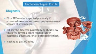 Diagnosis
 EA or TEF may be suspected prenatally if
ultrasound examination reveals polyhydraminos or
absence of stomach gas.
 TEF may be detected postnatally by chest x-ray
which will reveal a coiled feeding tube in
esophageal pouch and/or air distended stomach.
 Inability to pass NG tube.
Tracheoesophageal Fistula
 