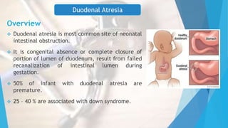 Overview
 Duodenal atresia is most common site of neonatal
intestinal obstruction.
 It is congenital absence or complete closure of
portion of lumen of duodenum, result from failed
recanalization of intestinal lumen during
gestation.
 50% of infant with duodenal atresia are
premature.
 25 – 40 % are associated with down syndrome.
Duodenal Atresia
 