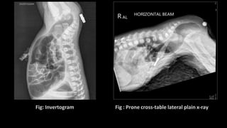 common surgical problem in pediatrics done.pptx