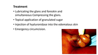 Treatment
• Lubricating the glans and foreskin and
simultaneous Compressing the glans.
• Topical application of granulated sugar
• Injection of hyaluronidase into the edematous skin
• Emergency circumcision.
 
