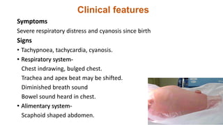Clinical features
Symptoms
Severe respiratory distress and cyanosis since birth
Signs
• Tachypnoea, tachycardia, cyanosis.
• Respiratory system-
Chest indrawing, bulged chest.
Trachea and apex beat may be shifted.
Diminished breath sound
Bowel sound heard in chest.
• Alimentary system-
Scaphoid shaped abdomen.
 