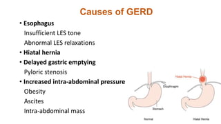 Diaphragm
Causes of GERD
• Esophagus
Insufficient LES tone
Abnormal LES relaxations
• Hiatal hernia
• Delayed gastric emptying
Pyloric stenosis
• Increased intra-abdominal pressure
Obesity
Ascites
Intra-abdominal mass
 