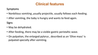Clinical features
Symptoms
• Nonbilious vomiting ,usually projectile, usually follows each feeding.
• After vomiting, the baby is hungry and wants to feed again.
Signs
• May be dehydrated.
• After feeding, there may be a visible gastric peristaltic wave.
• On palpation, the enlarged pylorus , described as an ‘Olive mass’ is
palpated specially after vomiting.
 