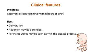 Clinical features
Symptoms
Recurrent Bilious vomiting.(within hours of birth)
Signs
• Dehydration
• Abdomen may be distended.
• Peristaltic waves may be seen early in the disease process.
 