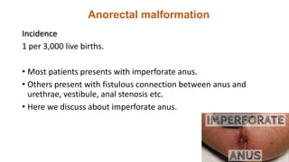 Anorectal malformation
Incidence
1 per 3,000 live births.
• Most patients presents with imperforate anus.
• Others present with fistulous connection between anus and
urethrae, vestibule, anal stenosis etc.
• Here we discuss about imperforate anus.
 