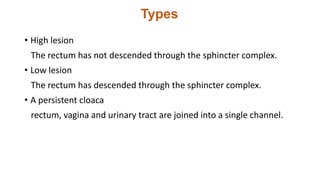 Types
• High lesion
The rectum has not descended through the sphincter complex.
• Low lesion
The rectum has descended through the sphincter complex.
• A persistent cloaca
rectum, vagina and urinary tract are joined into a single channel.
 