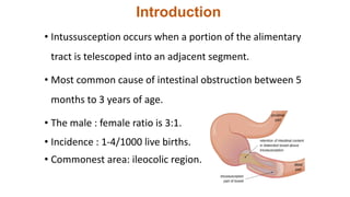 Introduction
• Intussusception occurs when a portion of the alimentary
tract is telescoped into an adjacent segment.
• Most common cause of intestinal obstruction between 5
months to 3 years of age.
• The male : female ratio is 3:1.
• Incidence : 1-4/1000 live births.
• Commonest area: ileocolic region.
 