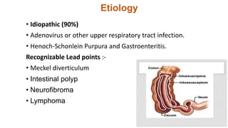 Etiology
• Idiopathic (90%)
• Adenovirus or other upper respiratory tract infection.
• Henoch-Schonlein Purpura and Gastroenteritis.
Recognizable Lead points :-
• Meckel diverticulum
• Intestinal polyp
• Neurofibroma
• Lymphoma
 