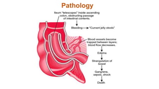 Pathology
 