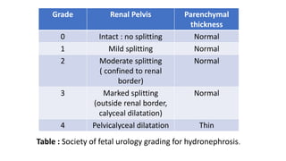 Table : Society of fetal urology grading for hydronephrosis.
Grade Renal Pelvis Parenchymal
thickness
0 Intact : no splitting Normal
1 Mild splitting Normal
2 Moderate splitting
( confined to renal
border)
Normal
3 Marked splitting
(outside renal border,
calyceal dilatation)
Normal
4 Pelvicalyceal dilatation Thin
 