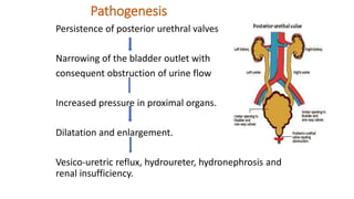 Pathogenesis
Persistence of posterior urethral valves
Narrowing of the bladder outlet with
consequent obstruction of urine flow
Increased pressure in proximal organs.
Dilatation and enlargement.
Vesico-uretric reflux, hydroureter, hydronephrosis and
renal insufficiency.
 
