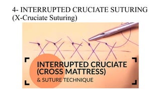 Suturing Patterns Common Suturing Techniques and Patterns in Surgery | Art of Suturing | PPTX