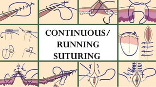 Suturing Patterns Common Suturing Techniques and Patterns in Surgery | Art of Suturing | PPTX