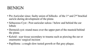 COMMON TUMORS IN ENT BY LOVENESS ULUNJI CHAWINGA.pdf