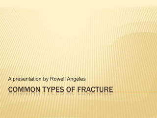 Common Types of Fracture A presentation by Rowell Angeles 