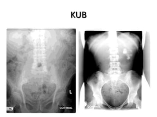 Common Urological Emergencies | PPTX