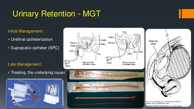 Urinary Retention In Flexeril How Severe And When It Was Urinary Retention In Flexeril How Severe And When It Was