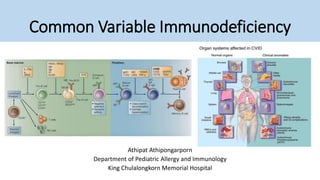 Common Variable Immunodeficiency
Athipat Athipongarporn
Department of Pediatric Allergy and Immunology
King Chulalongkorn Memorial Hospital
 