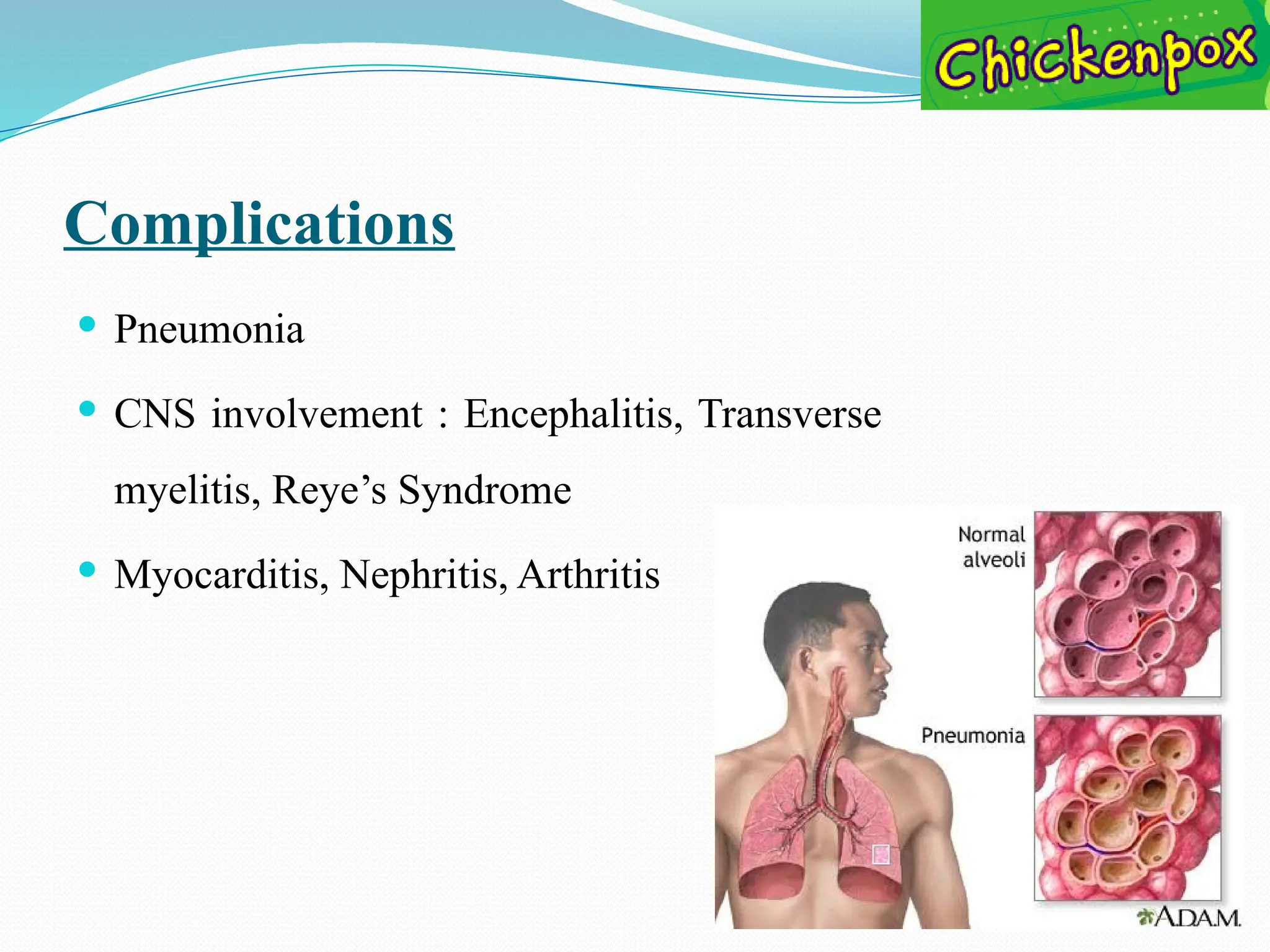Complications
 Pneumonia
 CNS involvement : Encephalitis, Transverse
myelitis, Reye’s Syndrome
 Myocarditis, Nephritis, Arthritis
 