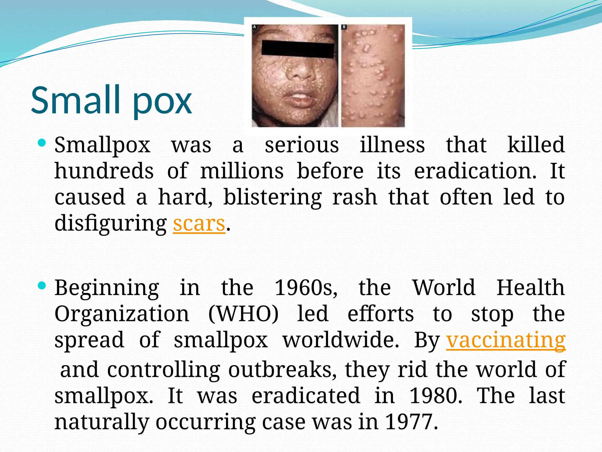 Small pox
 Smallpox was a serious illness that killed
hundreds of millions before its eradication. It
caused a hard, blistering rash that often led to
disfiguring scars.
 Beginning in the 1960s, the World Health
Organization (WHO) led efforts to stop the
spread of smallpox worldwide. By vaccinating
and controlling outbreaks, they rid the world of
smallpox. It was eradicated in 1980. The last
naturally occurring case was in 1977.
 