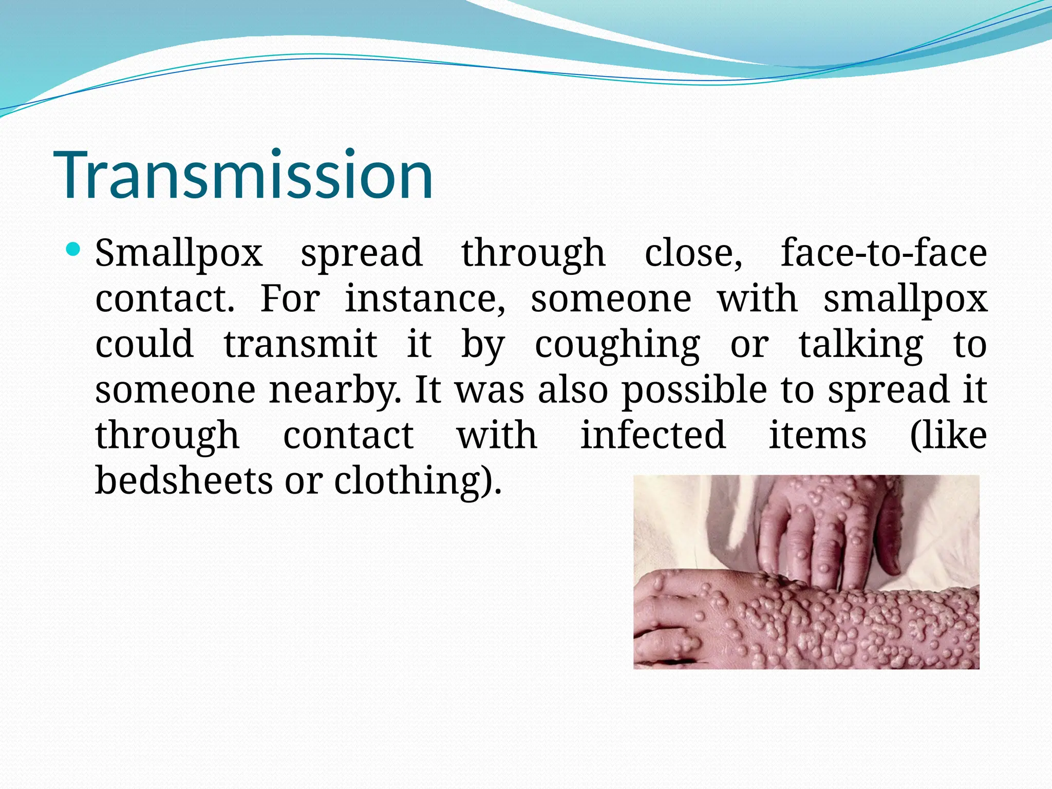 Transmission
 Smallpox spread through close, face-to-face
contact. For instance, someone with smallpox
could transmit it by coughing or talking to
someone nearby. It was also possible to spread it
through contact with infected items (like
bedsheets or clothing).
 