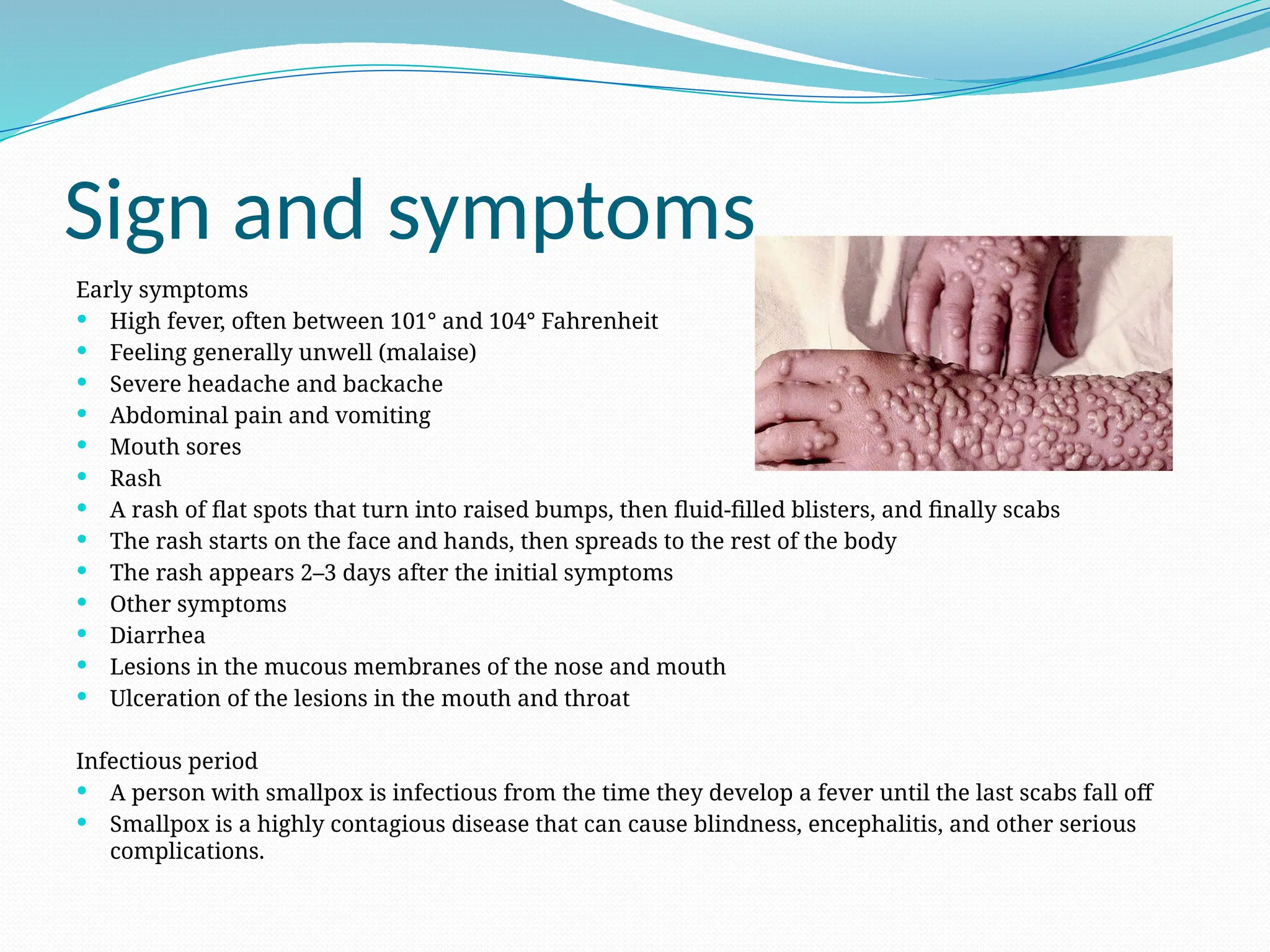 Sign and symptoms
Early symptoms
 High fever, often between 101° and 104° Fahrenheit
 Feeling generally unwell (malaise)
 Severe headache and backache
 Abdominal pain and vomiting
 Mouth sores
 Rash
 A rash of flat spots that turn into raised bumps, then fluid-filled blisters, and finally scabs
 The rash starts on the face and hands, then spreads to the rest of the body
 The rash appears 2–3 days after the initial symptoms
 Other symptoms
 Diarrhea
 Lesions in the mucous membranes of the nose and mouth
 Ulceration of the lesions in the mouth and throat
Infectious period
 A person with smallpox is infectious from the time they develop a fever until the last scabs fall off
 Smallpox is a highly contagious disease that can cause blindness, encephalitis, and other serious
complications.
 