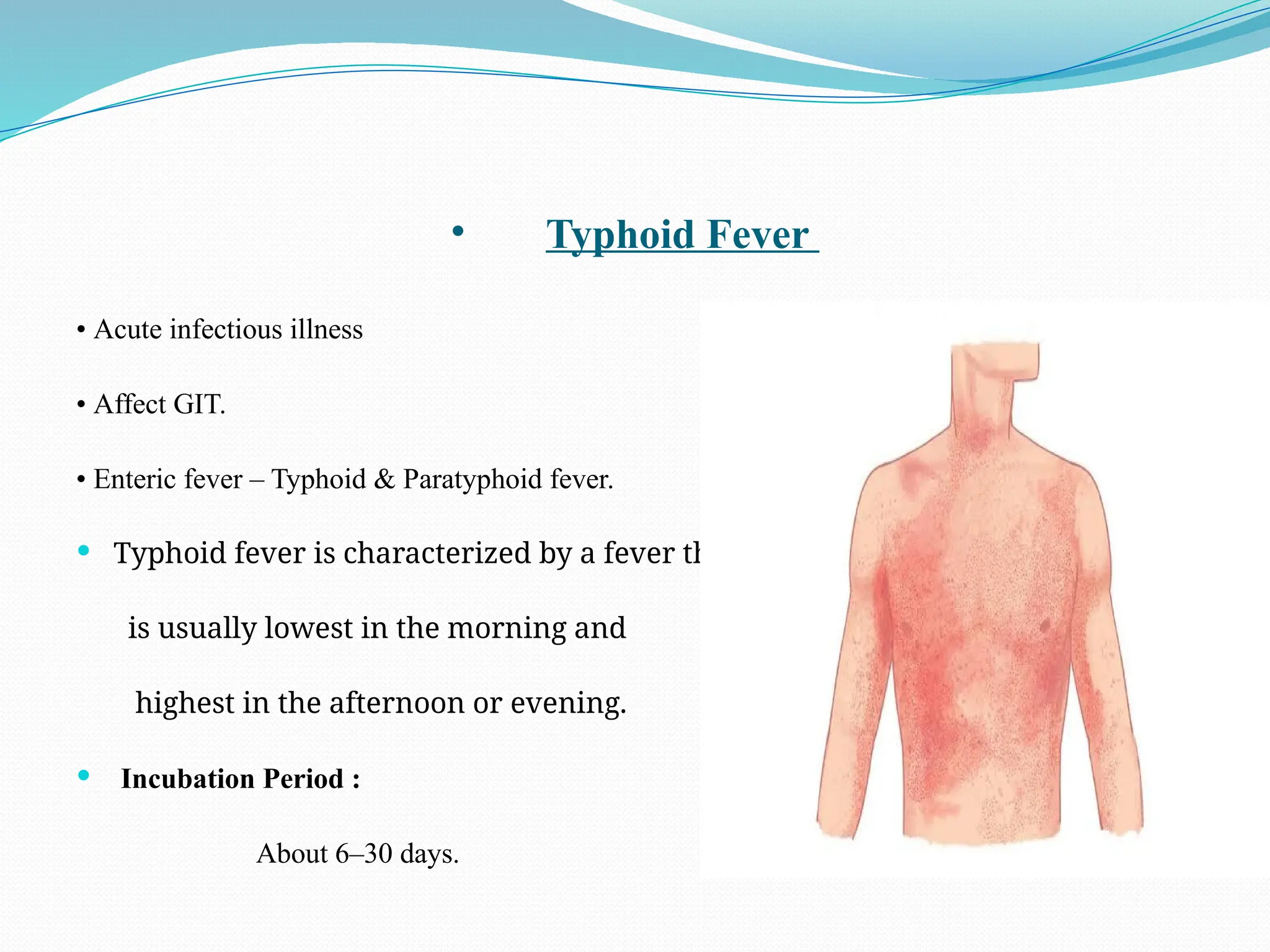 • Typhoid Fever
• Acute infectious illness
• Affect GIT.
• Enteric fever – Typhoid & Paratyphoid fever.
 Typhoid fever is characterized by a fever that
is usually lowest in the morning and
highest in the afternoon or evening.
 Incubation Period :
About 6–30 days.
 