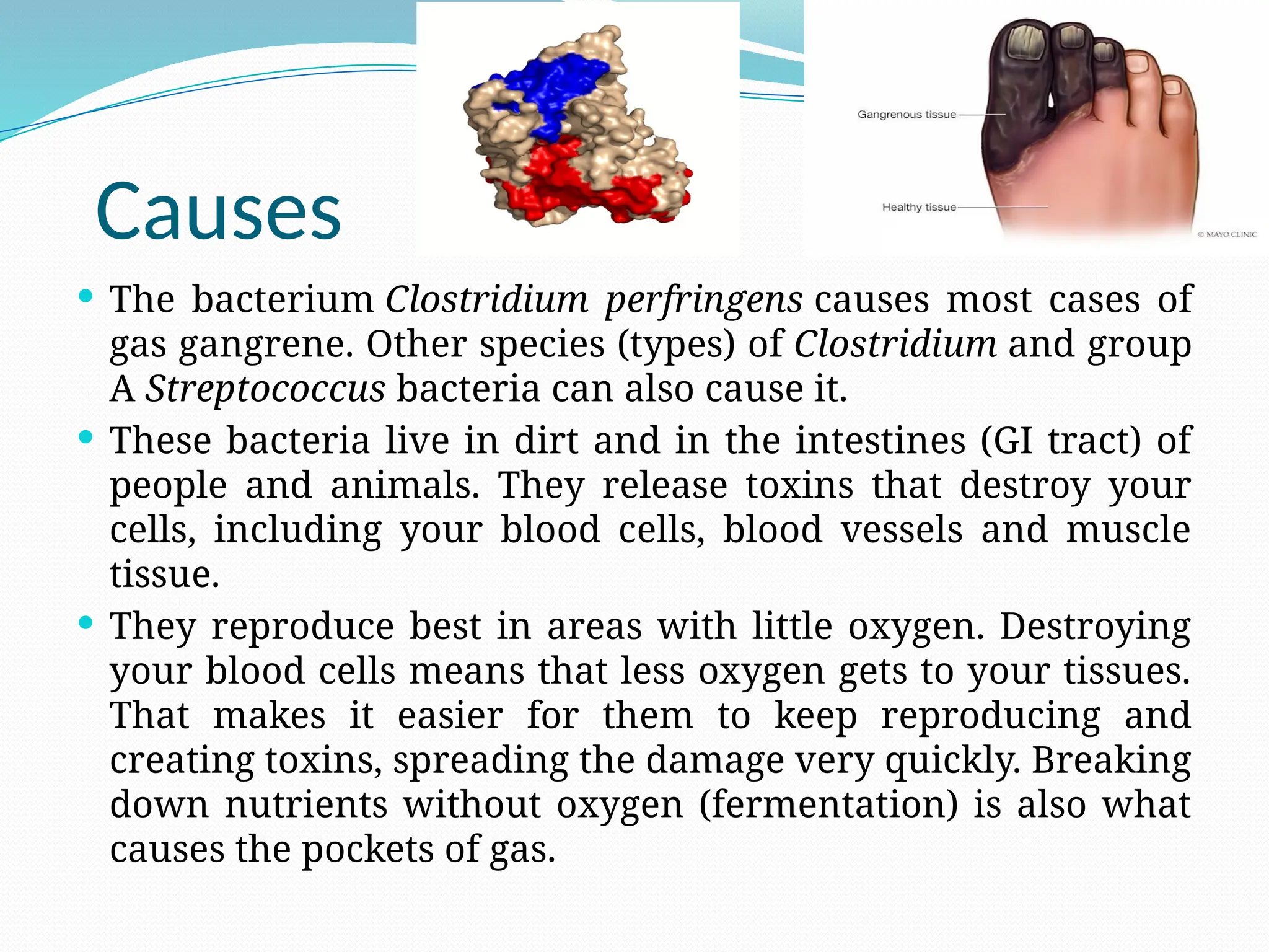 Causes
 The bacterium Clostridium perfringens causes most cases of
gas gangrene. Other species (types) of Clostridium and group
A Streptococcus bacteria can also cause it.
 These bacteria live in dirt and in the intestines (GI tract) of
people and animals. They release toxins that destroy your
cells, including your blood cells, blood vessels and muscle
tissue.
 They reproduce best in areas with little oxygen. Destroying
your blood cells means that less oxygen gets to your tissues.
That makes it easier for them to keep reproducing and
creating toxins, spreading the damage very quickly. Breaking
down nutrients without oxygen (fermentation) is also what
causes the pockets of gas.
 