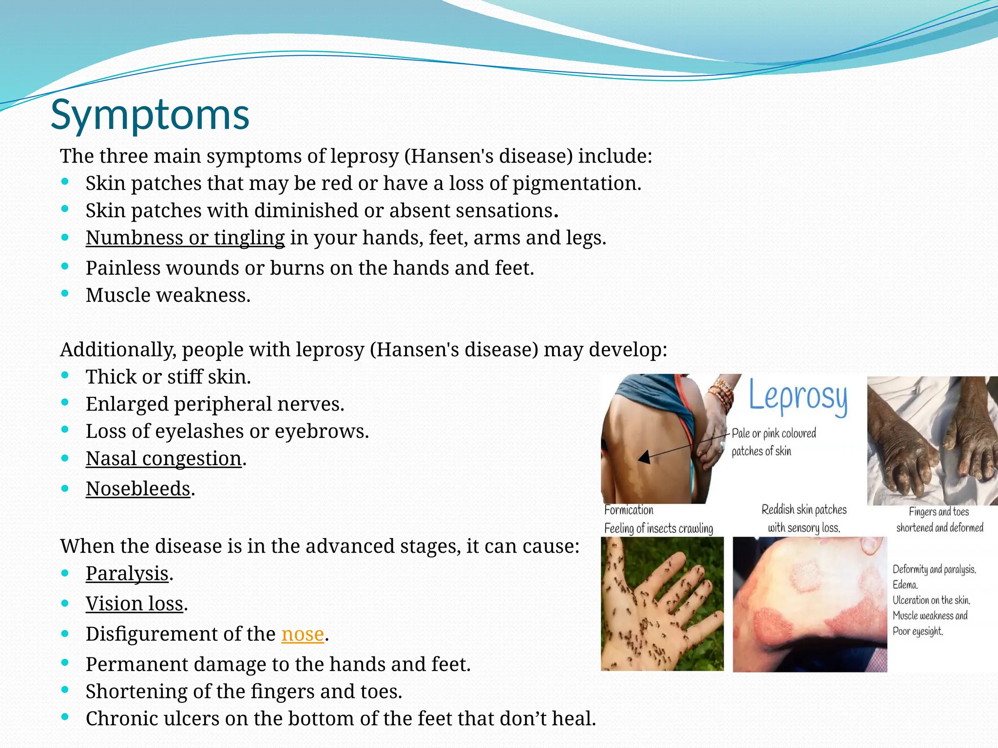 Symptoms
The three main symptoms of leprosy (Hansen's disease) include:
 Skin patches that may be red or have a loss of pigmentation.
 Skin patches with diminished or absent sensations.
 Numbness or tingling in your hands, feet, arms and legs.
 Painless wounds or burns on the hands and feet.
 Muscle weakness.
Additionally, people with leprosy (Hansen's disease) may develop:
 Thick or stiff skin.
 Enlarged peripheral nerves.
 Loss of eyelashes or eyebrows.
 Nasal congestion.
 Nosebleeds.
When the disease is in the advanced stages, it can cause:
 Paralysis.
 Vision loss.
 Disfigurement of the nose.
 Permanent damage to the hands and feet.
 Shortening of the fingers and toes.
 Chronic ulcers on the bottom of the feet that don’t heal.
 