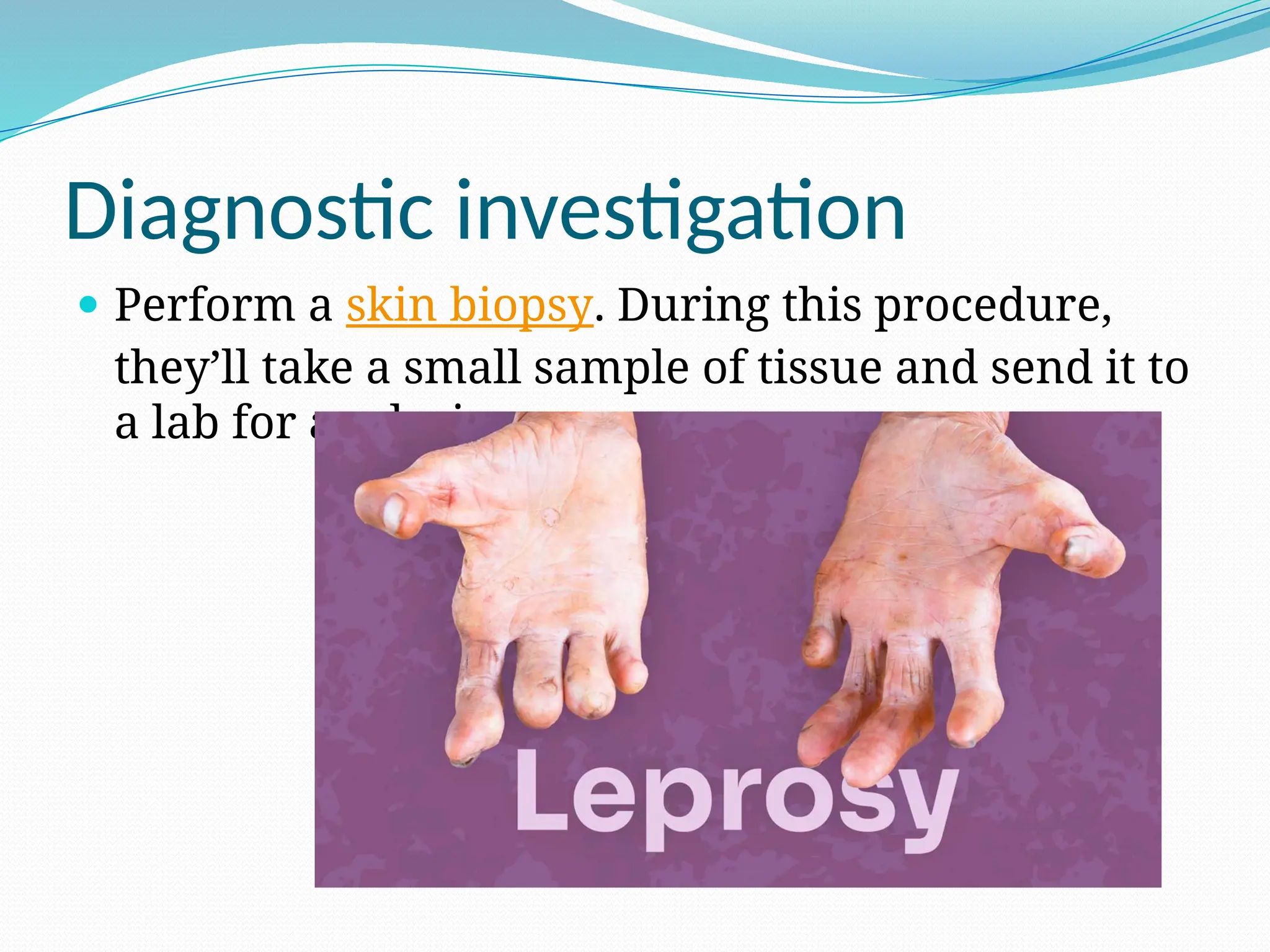 Diagnostic investigation
 Perform a skin biopsy. During this procedure,
they’ll take a small sample of tissue and send it to
a lab for analysis.
 
