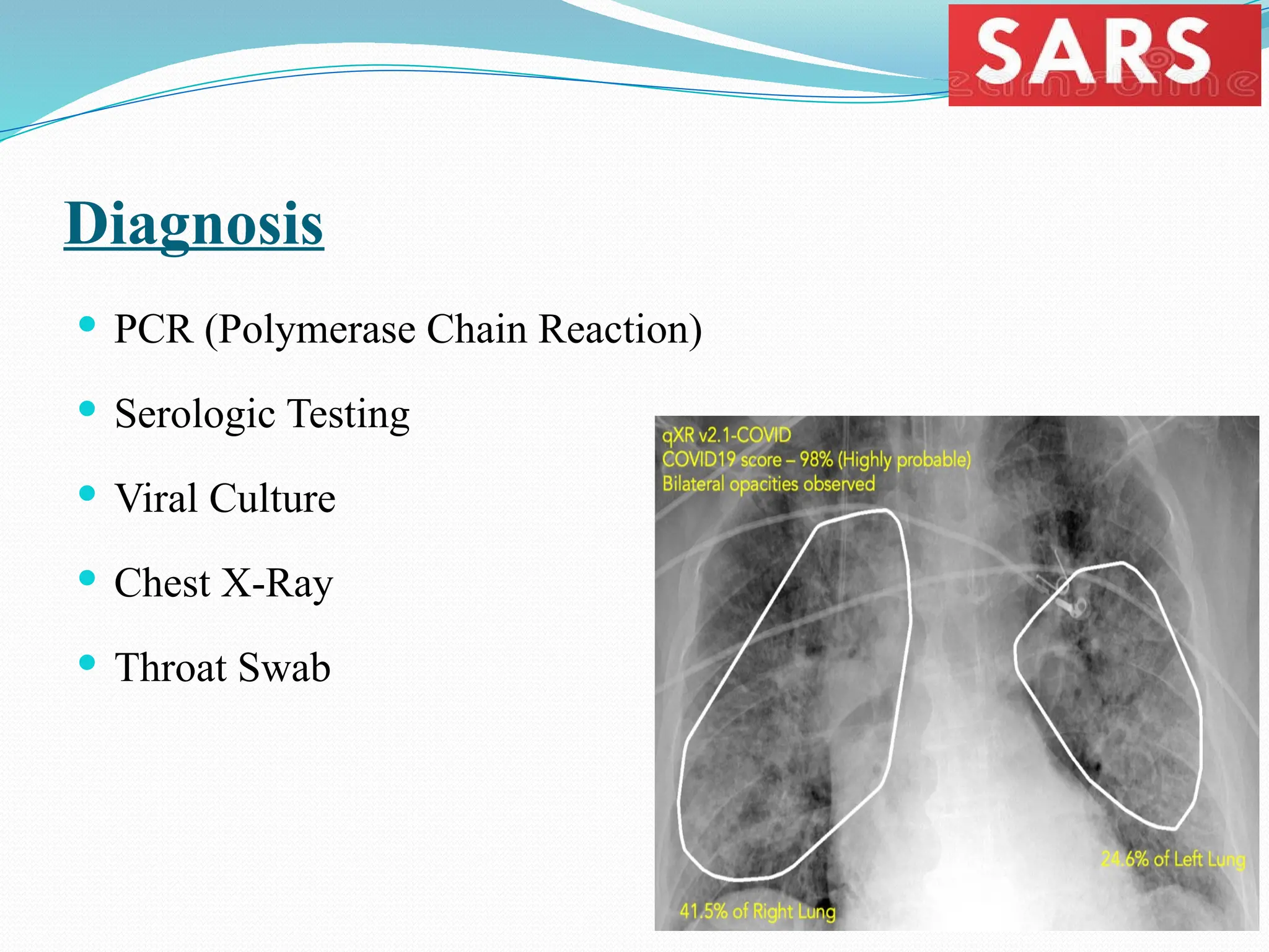 Diagnosis
 PCR (Polymerase Chain Reaction)
 Serologic Testing
 Viral Culture
 Chest X-Ray
 Throat Swab
 