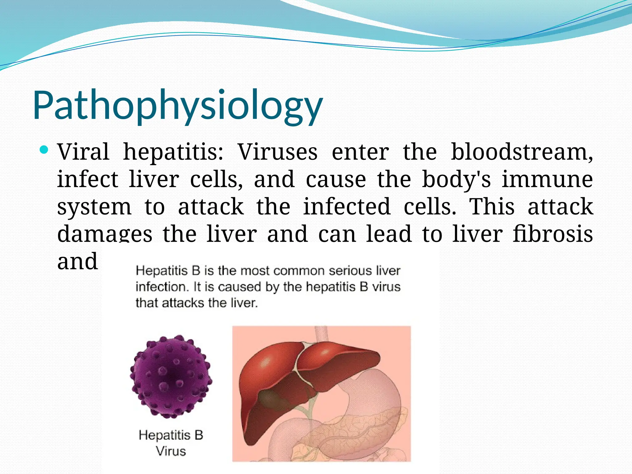 Pathophysiology
 Viral hepatitis: Viruses enter the bloodstream,
infect liver cells, and cause the body's immune
system to attack the infected cells. This attack
damages the liver and can lead to liver fibrosis
and cirrhosis.
 