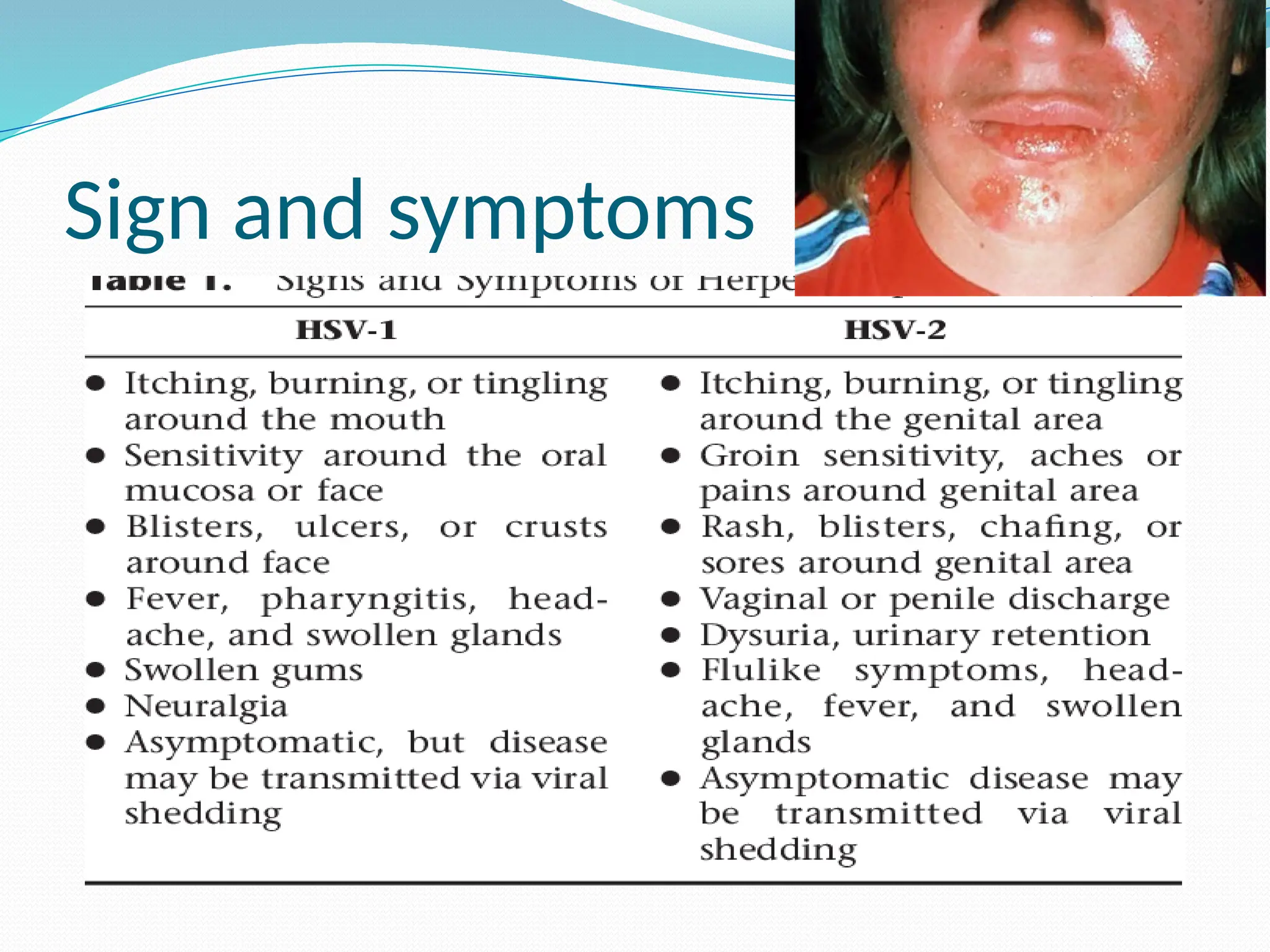 Sign and symptoms
 