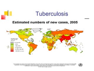 Tuberculosis
 