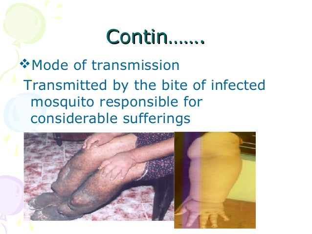Communicable disease