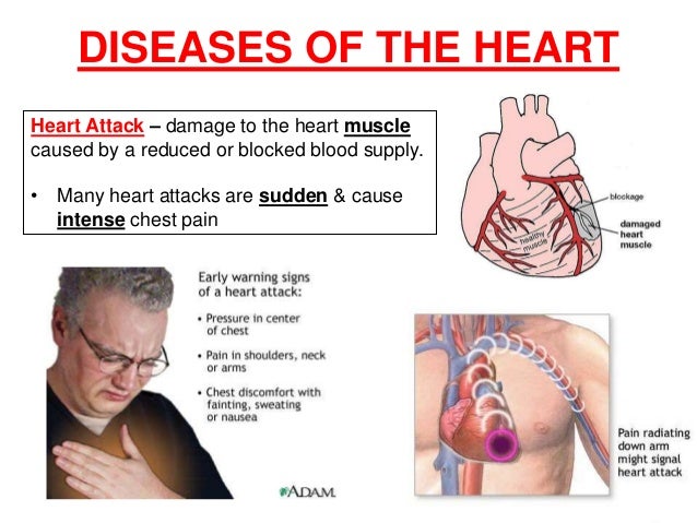 Communicable disease