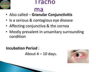 • Also called – Granular Conjunctivitis
• Is a serious & contagious eye disease
• Affecting conjunctiva & the cornea
• Mostly prevalent in unsanitary surrounding
condition
Incubation Period :
About 4 – 10 days.
 