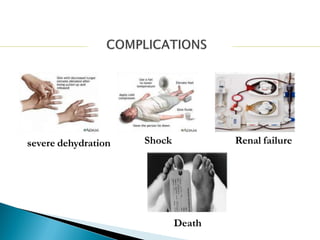 severe dehydration Shock Renal failure
Death
 