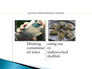ed water.
Drinking eating raw
contaminat or
undercooked
shellfish
CAUSES (TRANSMISSION MOOD)
 