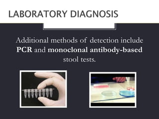 Additional methods of detection include
PCR and monoclonal antibody-based
stool tests.
 