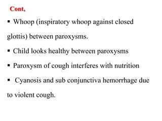 Cont,
 Whoop (inspiratory whoop against closed
glottis) between paroxysms.
 Child looks healthy between paroxysms
 Paroxysm of cough interferes with nutrition
 Cyanosis and sub conjunctiva hemorrhage due
to violent cough.
 