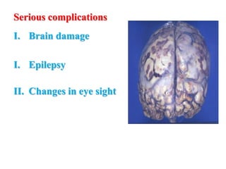 Serious complications
I. Brain damage
I. Epilepsy
II. Changes in eye sight
 