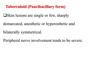 Tuberculoid (Paucibacillary form)
Skin lesions are single or few, sharply
demarcated, anesthetic or hyperesthetic and
bilaterally symmetrical.
Peripheral nerve involvement tends to be severe.
 