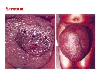 Scrotum
362
Zinabu D
 