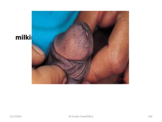 milking penis
5/11/2024 458
BY Zinabu Dawit(PBsc)
 