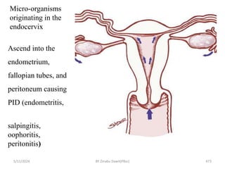 Micro-organisms
originating in the
endocervix
Ascend into the
endometrium,
fallopian tubes, and
peritoneum causing
PID (endometritis,
salpingitis,
oophoritis,
peritonitis)
5/11/2024 473
BY Zinabu Dawit(PBsc)
 