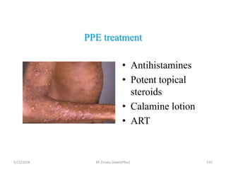 PPE treatment
5/11/2024 535
• Antihistamines
• Potent topical
steroids
• Calamine lotion
• ART
BY Zinabu Dawit(PBsc)
 