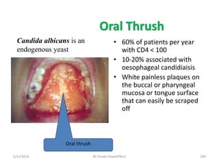 Oral Thrush
• 60% of patients per year
with CD4 < 100
• 10-20% associated with
oesophageal candidiaisis
• White painless plaques on
the buccal or pharyngeal
mucosa or tongue surface
that can easily be scraped
off
5/11/2024 544
Candida albicans is an
endogenous yeast
Oral thrush
BY Zinabu Dawit(PBsc)
 